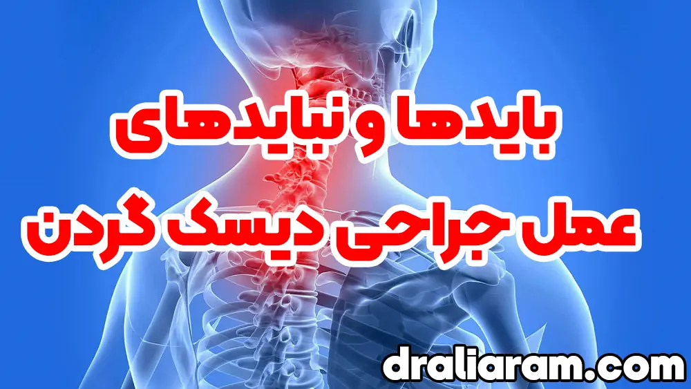 دیسک گردن