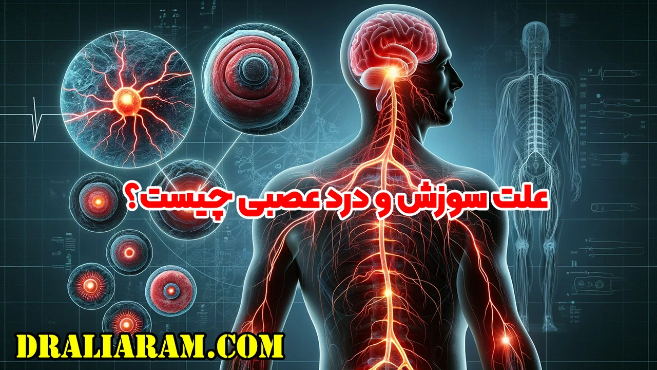 علت سوزش و درد عصبی