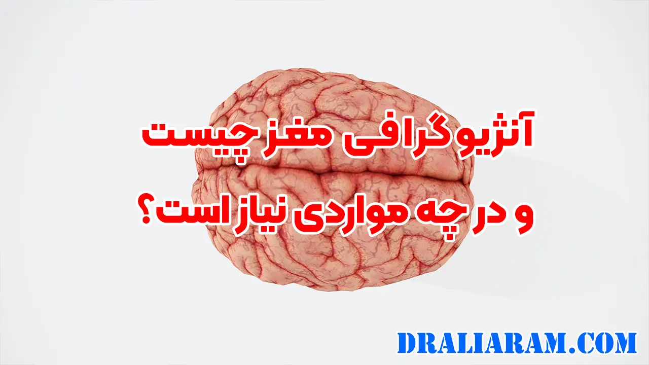 آنژیوگرافی مغز چیست و در چه مواردی نیاز است؟
