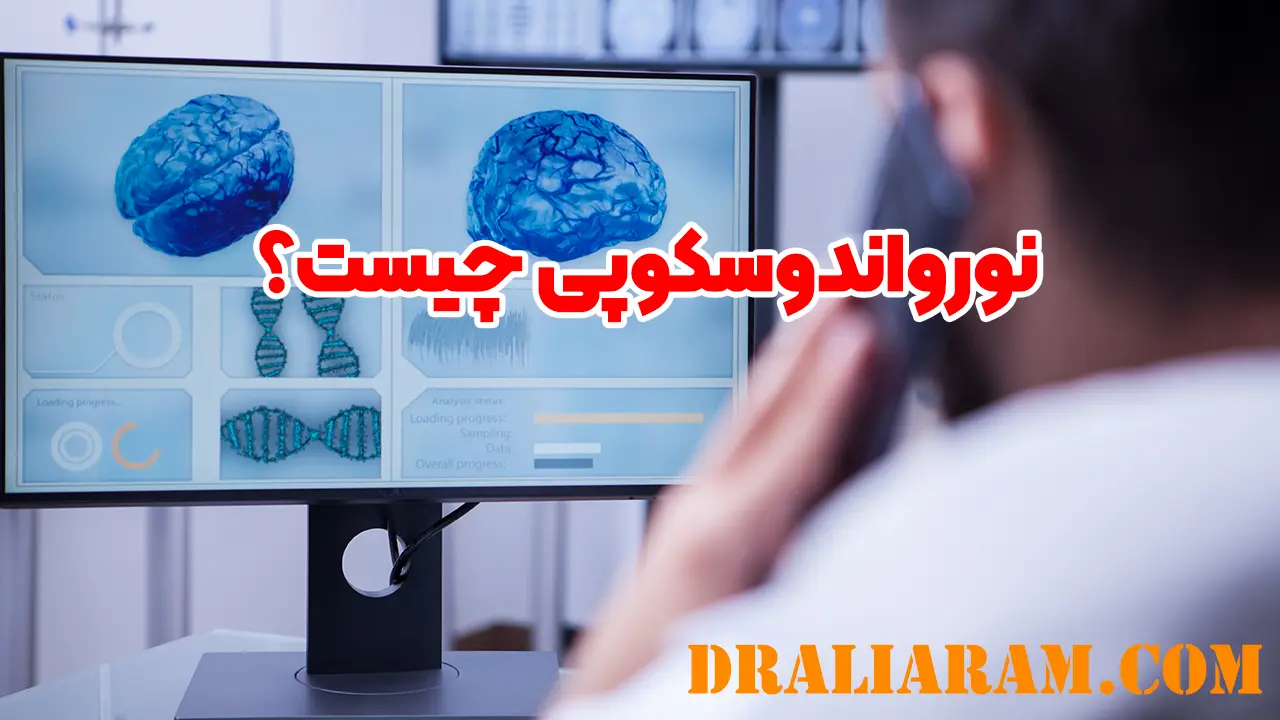 نورواندوسکوپی چیست؟