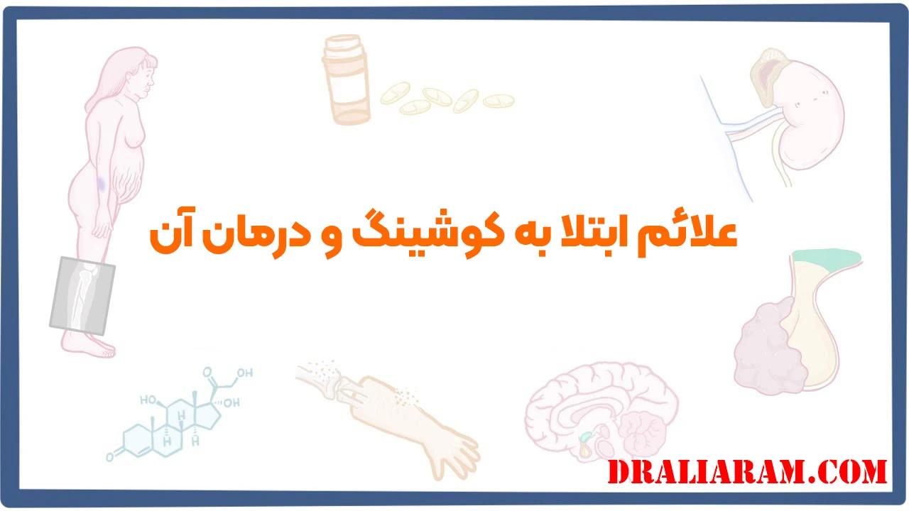 علائم ابتلا به کوشینگ و درمان آن
