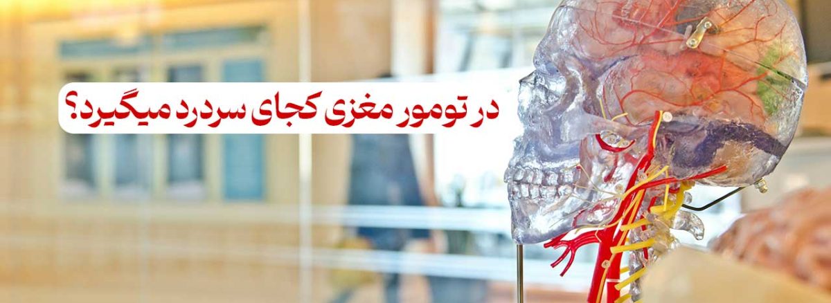 در تومور مغزی کجای سردرد میگیرد؟