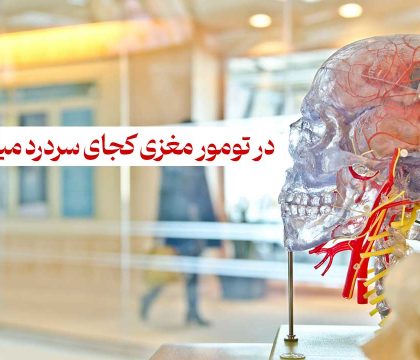 در تومور مغزی کجای سردرد میگیرد؟