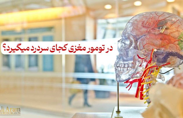 در تومور مغزی کجای سردرد میگیرد؟