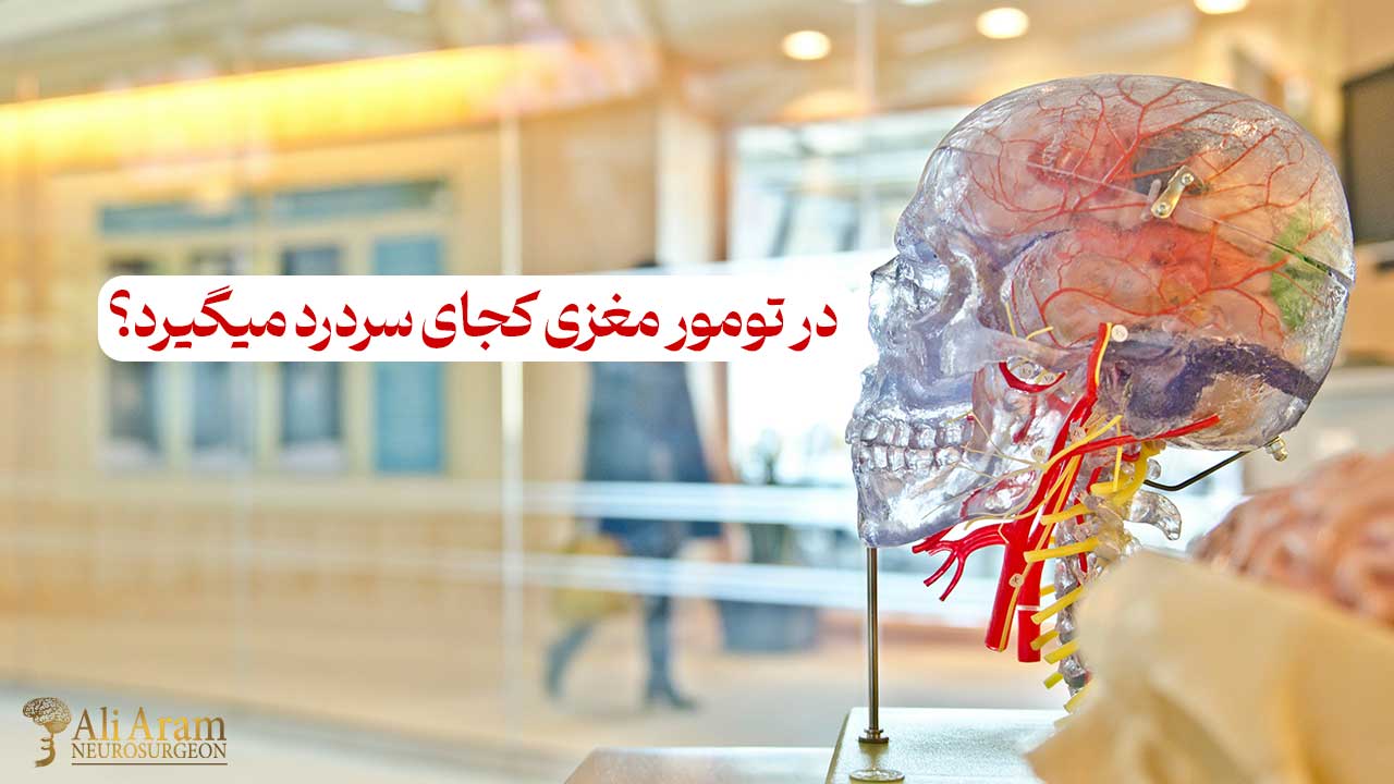 در تومور مغزی کجای سردرد میگیرد؟