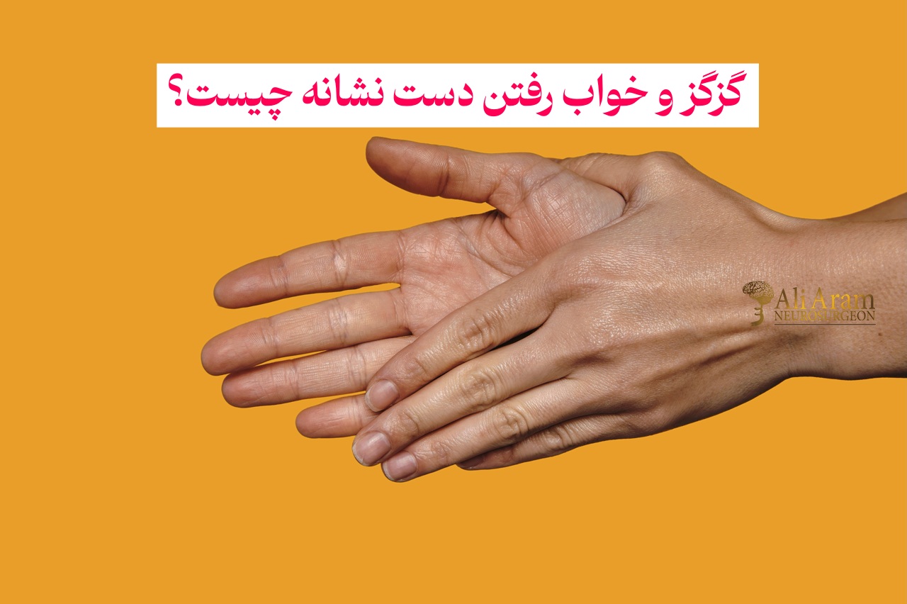 گزگز و خواب رفتن دست نشانه چیست؟ چگونه درمان می‌شود؟