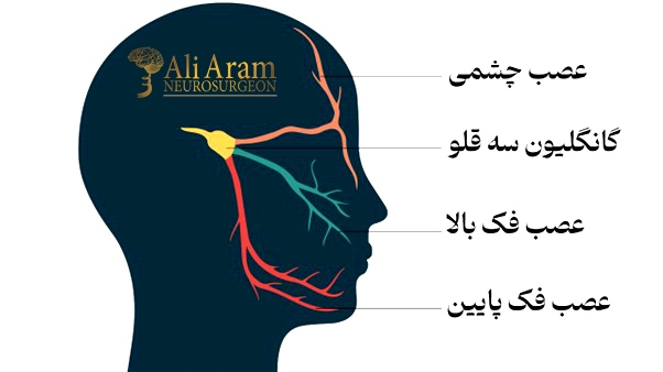 انواع مختلف نورالژی و درمان آنها