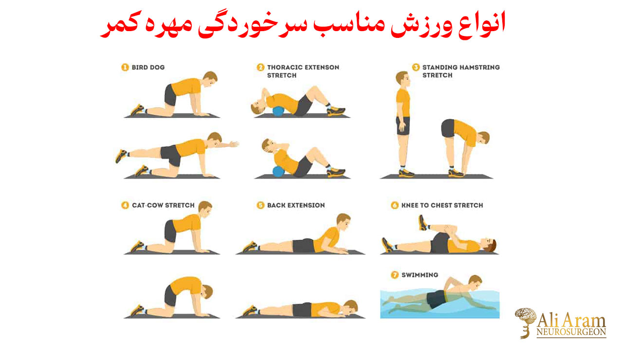 انواع ورزش مناسب سرخوردگی مهره کمر