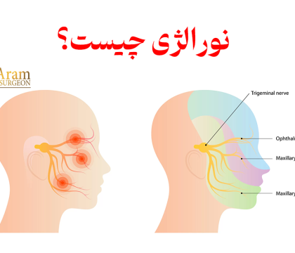 نورالژی چیست؟