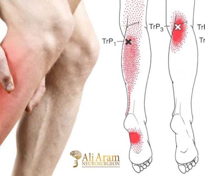 سندروم پای بی‌قرار چیست؟ علل، علائم، تشخیص و درمان