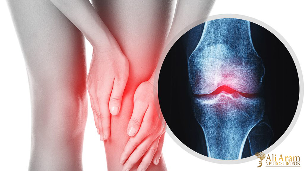 علت صدا دادن مفاصل (کریپتوس) و راه های درمان آن
