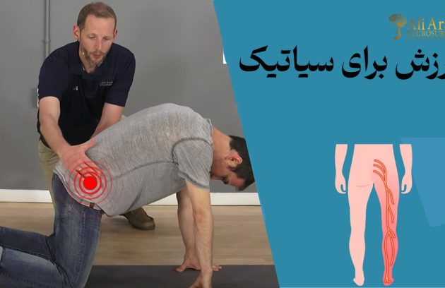 ورزش برای سیاتیک
