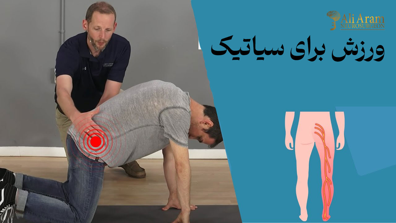 ورزش برای سیاتیک