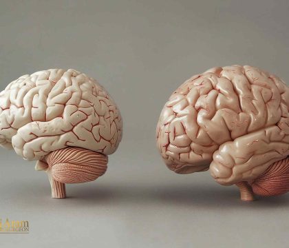 آیا کوچک شدن مغز خطرناک است؟